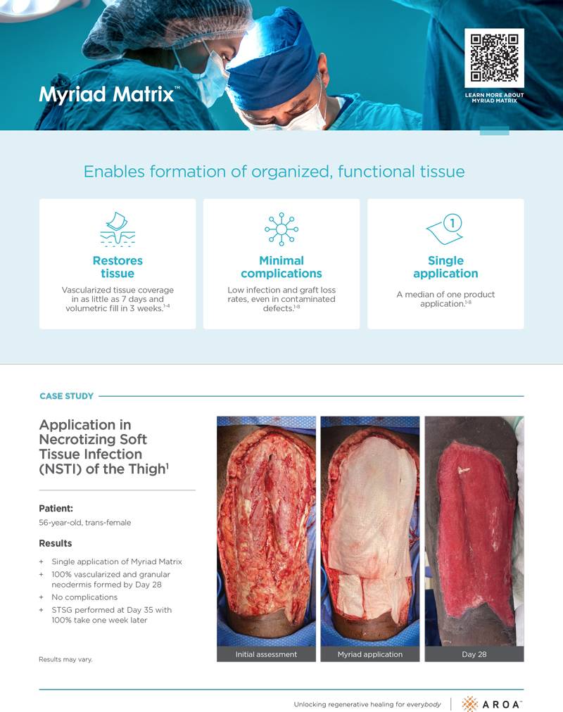 Myriad Matrix Brochure™